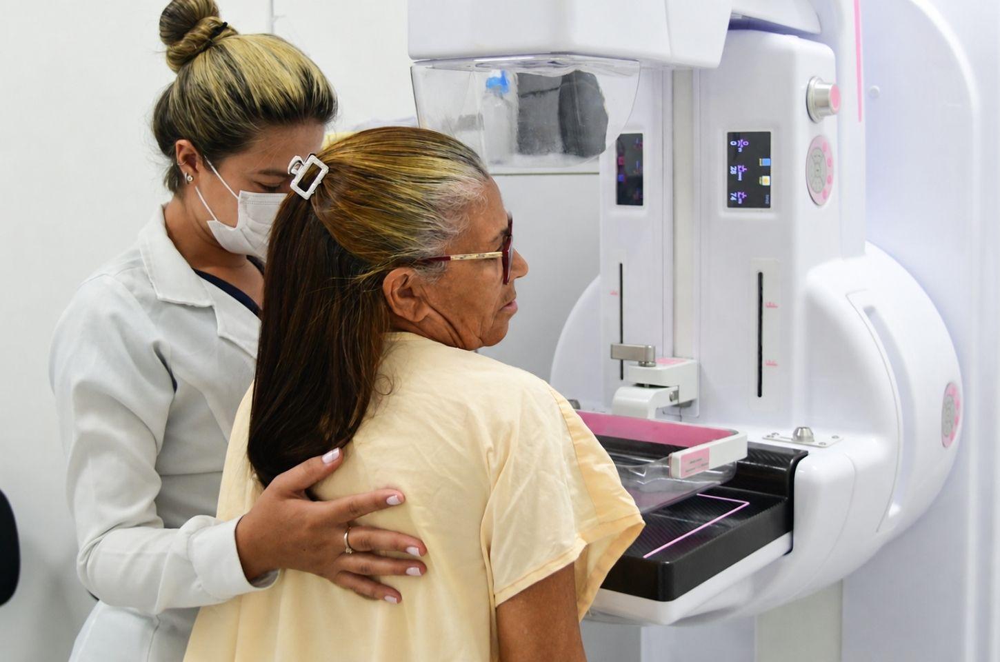 Mulheres podem agendar mamografia gratuita por telefone; saiba como